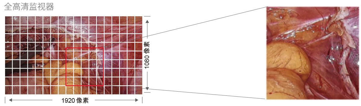 32英寸醫(yī)療手術(shù)室專用監(jiān)視器
