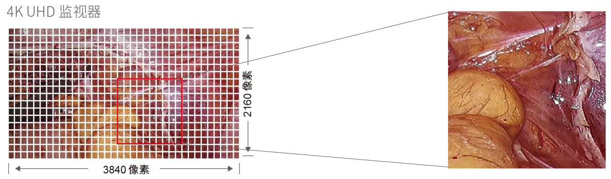 32英寸醫(yī)療手術(shù)室專用監(jiān)視器