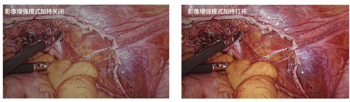 32英寸醫(yī)療手術(shù)室專(zhuān)用監(jiān)視器
